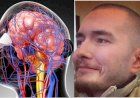 Возможна ли пересадка головы? История исследований