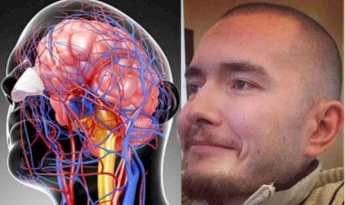 Возможна ли пересадка головы? История исследований