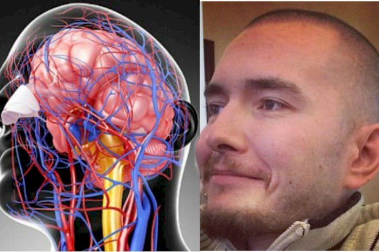 Is a head transplant possible? Research history IfBest
