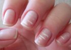 Почему появляются белые пятна на ногтях