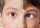 Синдром ленивого глаза и как не стать его жертвой