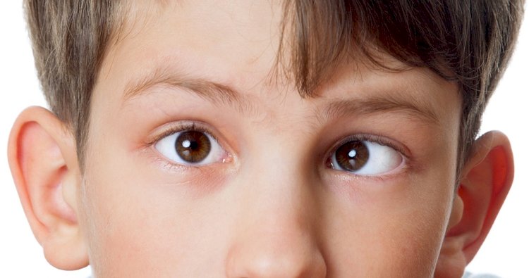 Синдром ленивого глаза и как не стать его жертвой