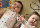 Двойняшкам Варе и Лере нужны деньги на лечение
