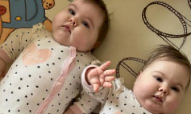 Двойняшкам Варе и Лере нужны деньги на лечение