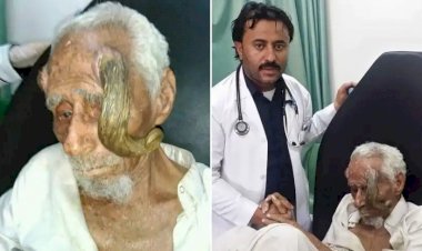 Долгожитель с «дьявольскими рогами»: в Йемене умер 140 летний мужчина