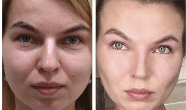 Что сделать, чтобы иметь четкие черты лица: эффективный метод от экспертов