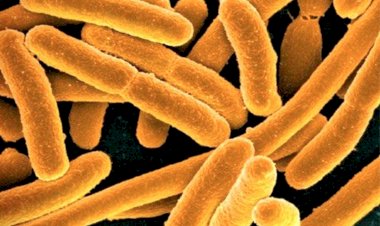 Кишечная палочка