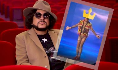 Было-стало: Филипп Киркоров в лосинах