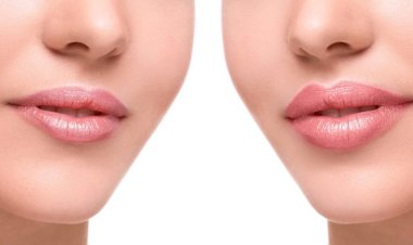Почему губы становятся тонкими и бледными, как вы  им можете помочь