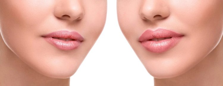 Почему губы становятся тонкими и бледными, как вы  им можете помочь
