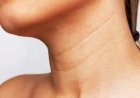 Кольца Венеры на шее - что это такое и что поможет их уменьшить