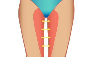 Как подтянуть внутреннюю поверхность бедра: 1 упражнение лежа