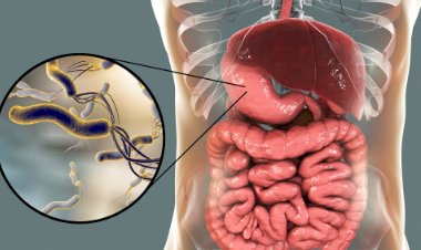 Избавляемся за 1 час от вздутия живота и лишнего веса