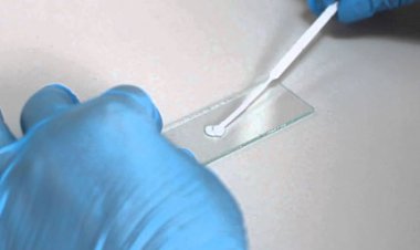 Мазок из уретры как пытка мужчин